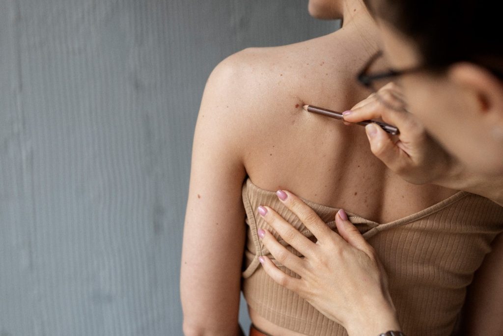 keloid treatment in Malaysia