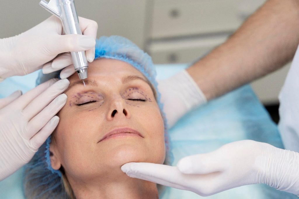 Blepharoplasty Malaysia 