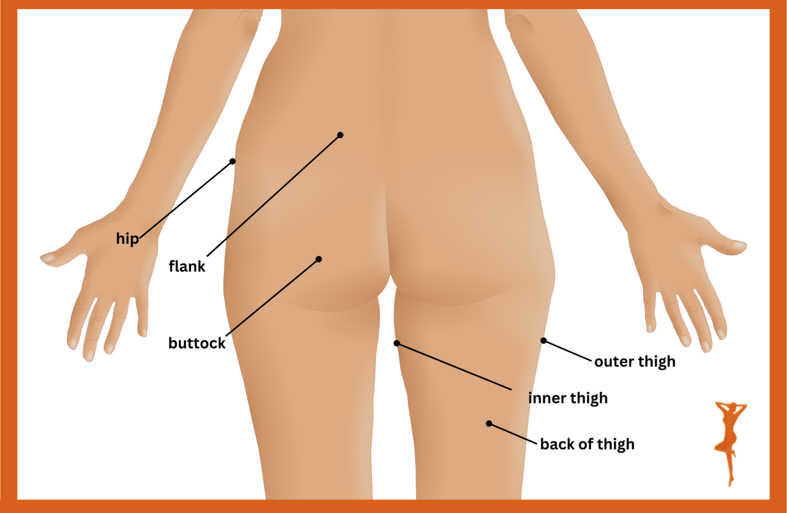 1778068125 diagram of back of woman with labelled body parts associated with buttocks liposuction 1536x1001