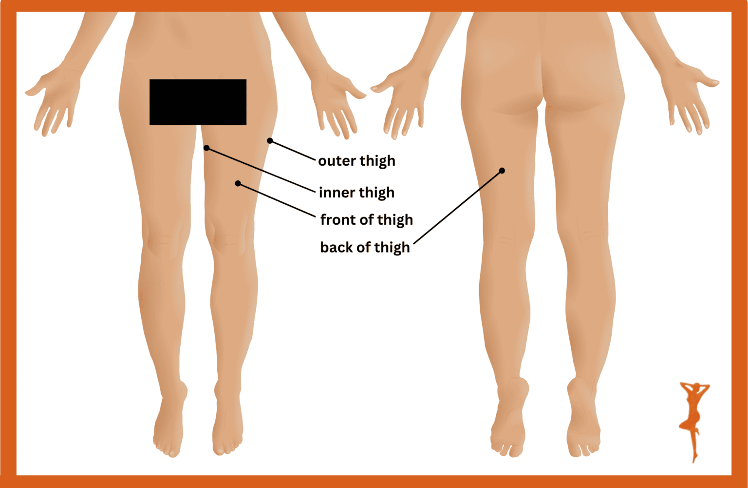 1778068961 diagram showing inner thigh outer thigh anterior thigh and posterior thigh for thigh liposuction procedure 1536x1001