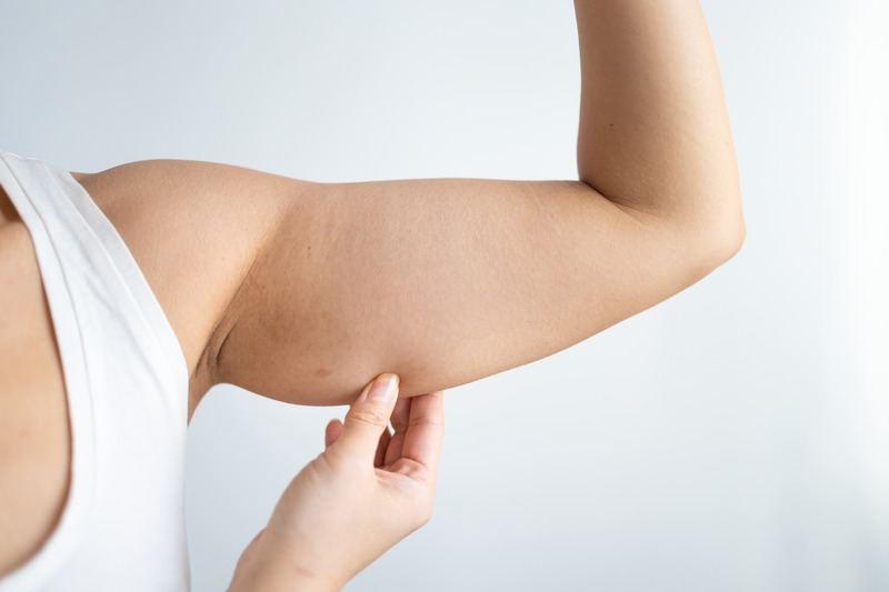 1778073493 upper arn fat deposits to show arm liposuction treatment area